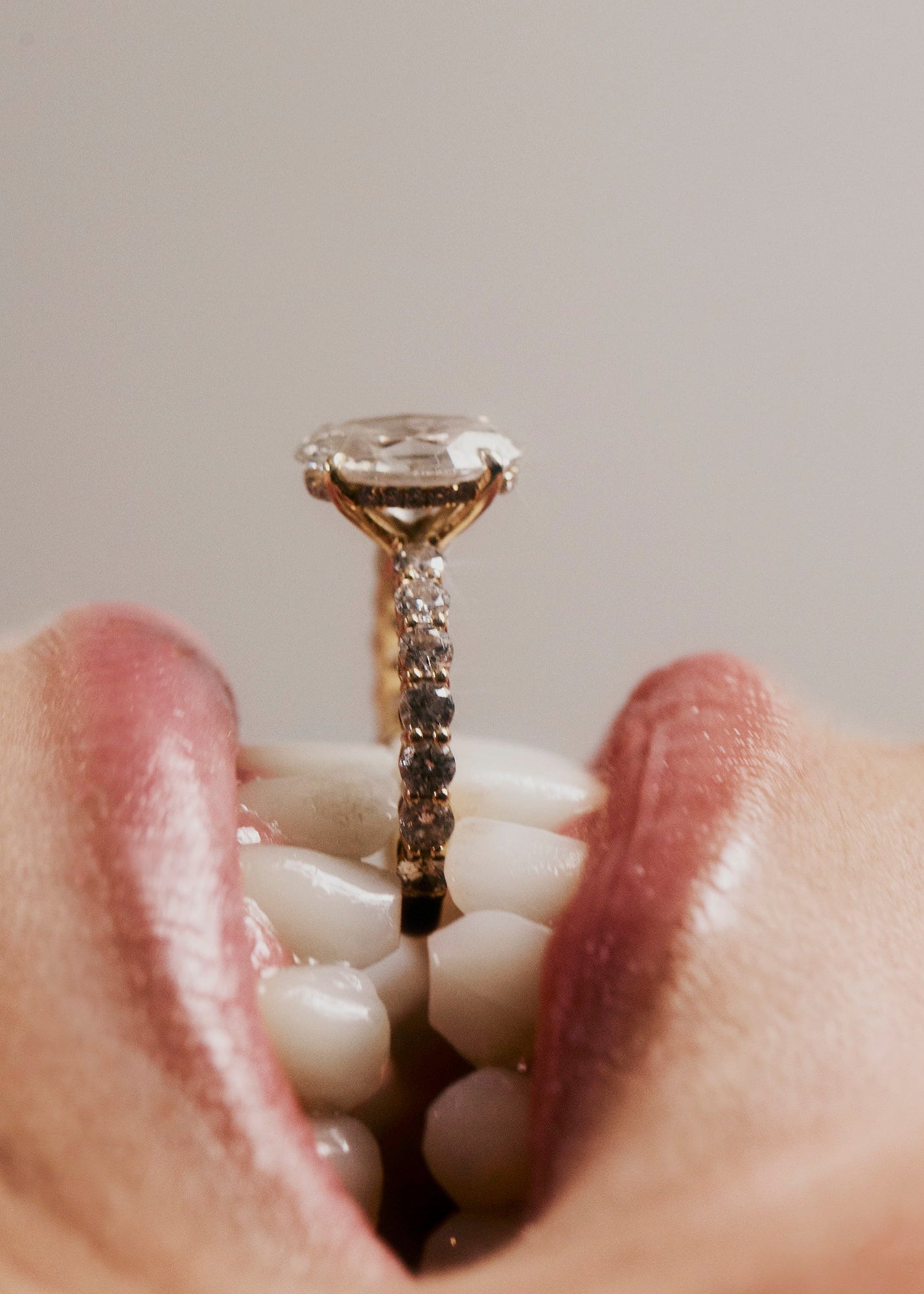 diamondengagementringinmouth
